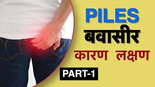 बवासीर के लक्षण क्या है  Dr Vasu  Piles symptoms in Hindi [upl. by Dnalyag241]