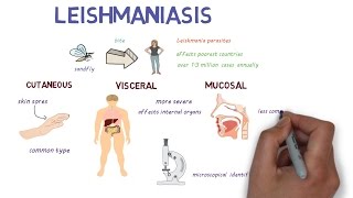 What is Leishmaniasis An introduction and overview [upl. by Osmen]