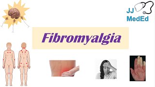 New Test For Fibromyalgia [upl. by Ielarol]