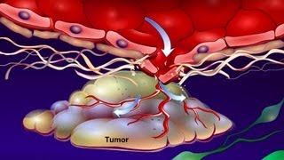 Introduction to Cancer Biology Part 4 Angiogenesis [upl. by Nisse]