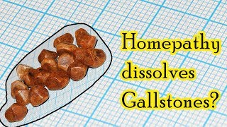 Can homeopathic medicine dissolve gallstones  Dr Sanjay Panicker [upl. by Nnalatsyrc255]