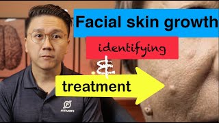 Growths on YOUR Face  Identifying and Treatment Part 12 [upl. by Analos]