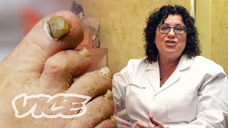 Meet a Toenail Fungus Expert [upl. by Minna]