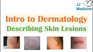 Introduction to Dermatology  The Basics  Describing Skin Lesions Primary amp Secondary Morphology [upl. by Klemm]