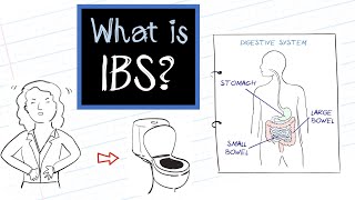 What is IBS Irritable Bowel Syndrome [upl. by Hildegaard]