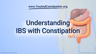 Understanding IBS with Constipation [upl. by Leima]