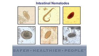 Diagnostic Features of Intestinal Nematodes [upl. by Alwin]