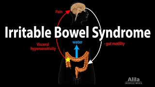 Irritable Bowel Syndrome IBS Signs amp Symptoms  Reasons for Why Symptoms Occur [upl. by Rahs150]