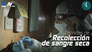 Técnica de Recolección de Sangre Seca [upl. by Corissa]