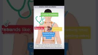 Chest Auscultation Identifying common BreathLung Sounds [upl. by Adilen]