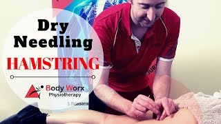 Dry Needling Hamstring  Jason Bradley BodyWorx Physio [upl. by Somerville110]