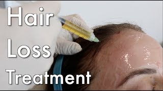 Hair Loss Treatment PRP [upl. by Revkah]