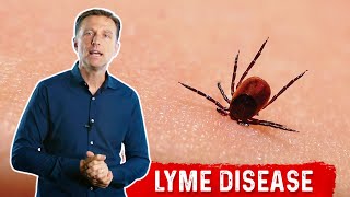 Do you know the signs of Lyme disease [upl. by Levona]