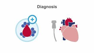 Endocarditis 101 Diagnosis and Treatment [upl. by Opportuna187]