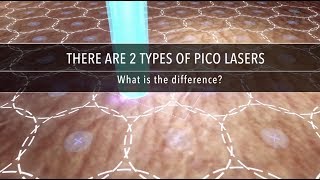 Why Are There Different Types of Pico Laser  Dr Kenneth Thean [upl. by Elesig348]