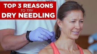 Top 3 Reasons to Try Dry Needling [upl. by Nrev]