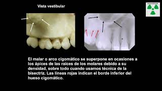 Anatomía radiológica Maxilar y mandibular [upl. by Kiefer]